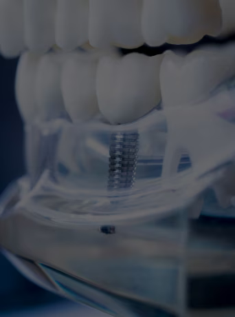 Illustration de la traçabilité des composants, du suivi qualité et de la conformité aux normes ISO 13485 dans l’industrie des dispositifs médicaux