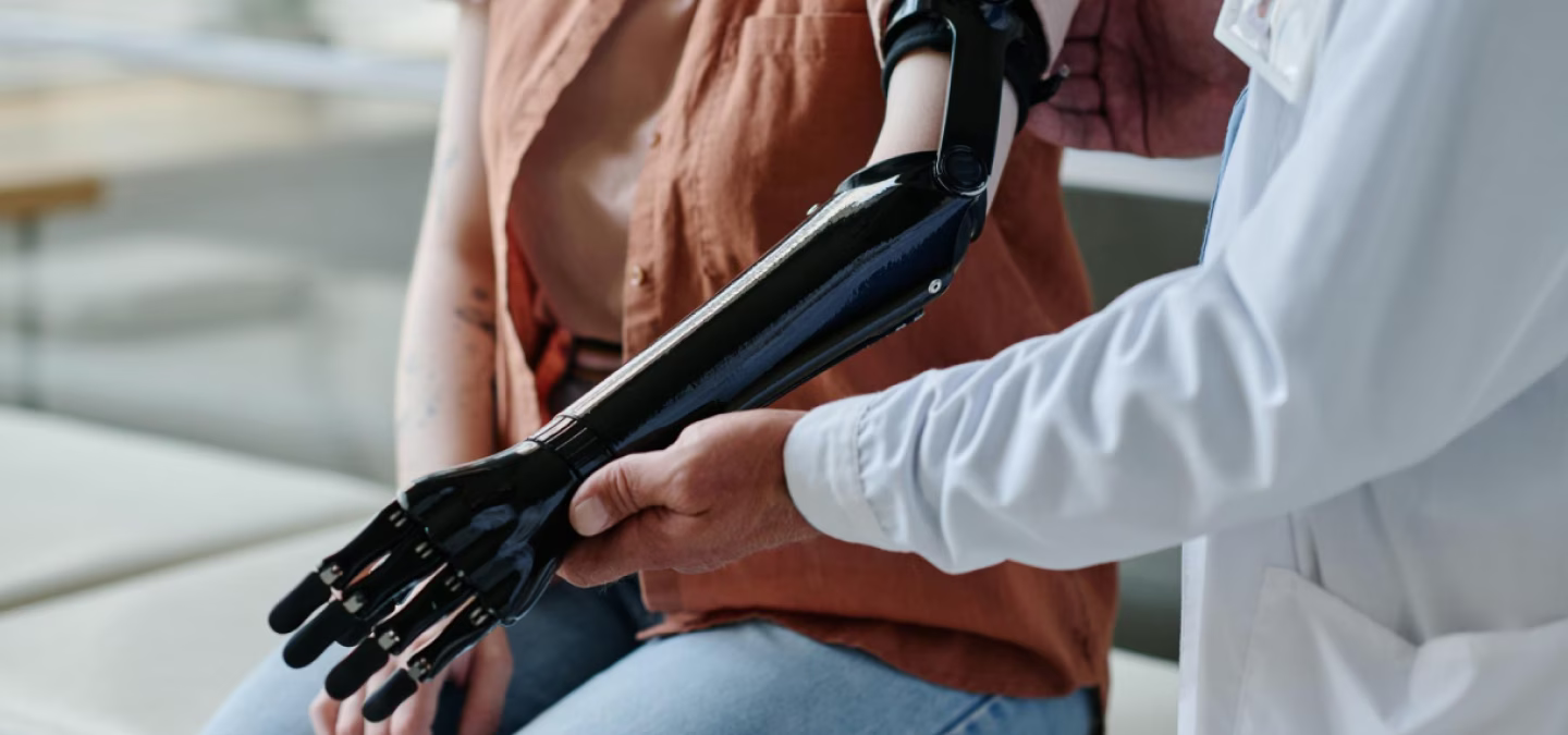 Installation d’une prothèse de bras bionique par un professionnel de santé